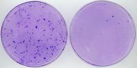 Tumor Suppressor BASP1