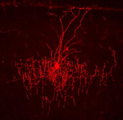Chandelier Cells Linked to Cortical Circuits (2 of 3)