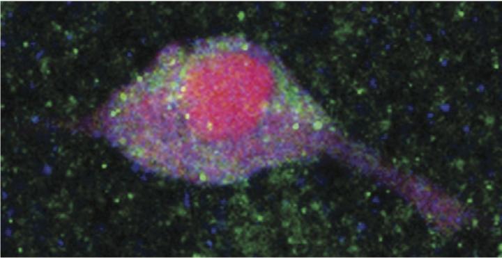 Insulin and Dopamine in the Brain