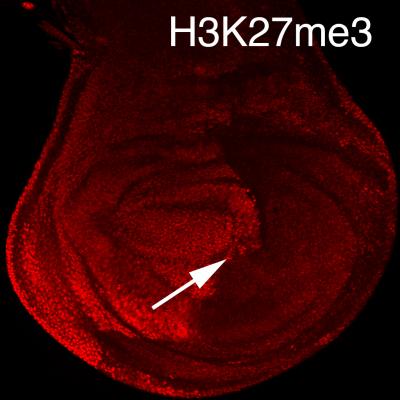 Histone Mutations