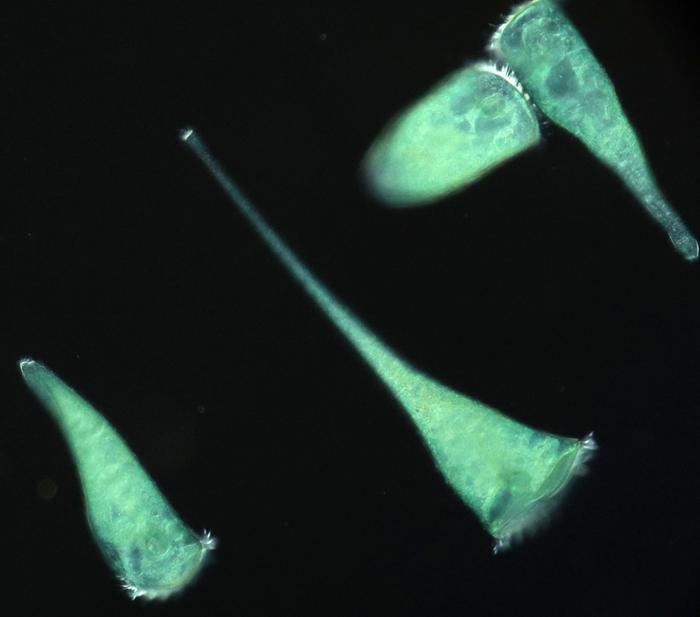Stentor coeruleus.