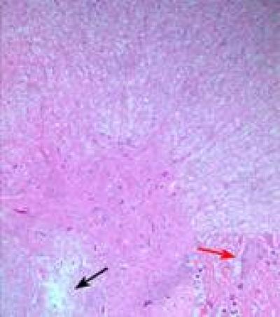 Hematoxylin-eosin Staining