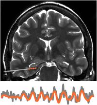 Brain scan