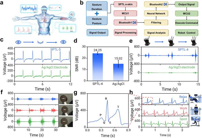 Smart Electronic Skin Enables Continuous Health Monitoring and Human–Machine Interaction