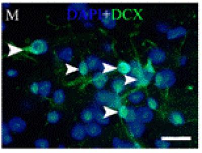 Immunostained