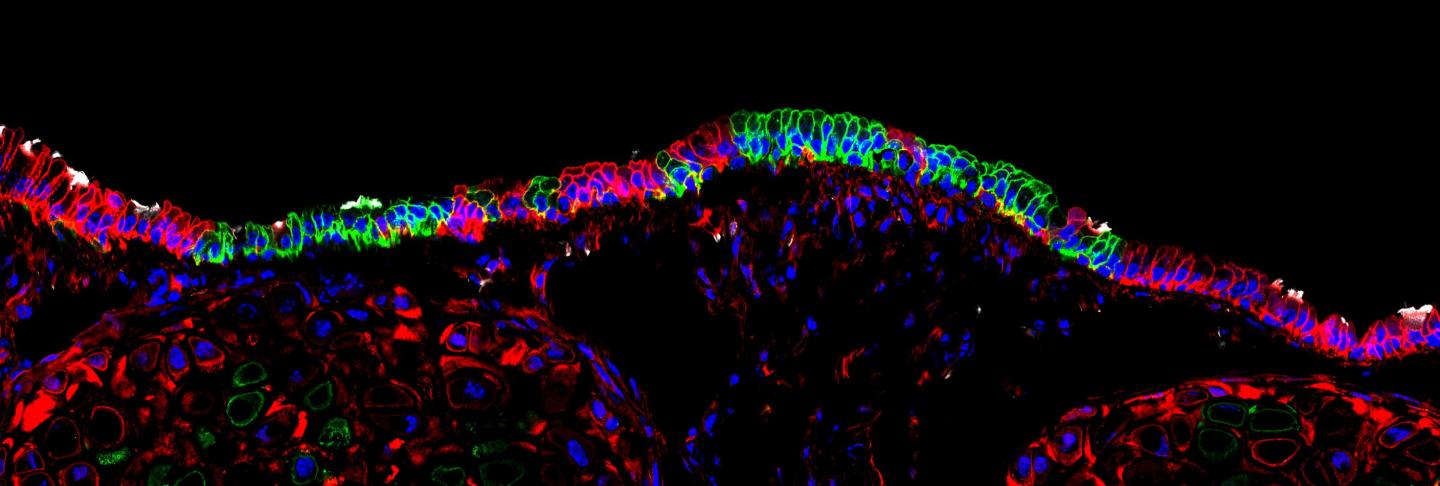 Lung Stem Cells