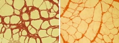 Muscle Deterioration in a Mouse Model of Duchenne Muscular Dystrophy