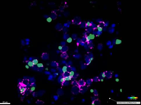 In Mice, a Rebooted Immunotherapy Safely Links T Cells to their Tumor Targets (4 of 5)