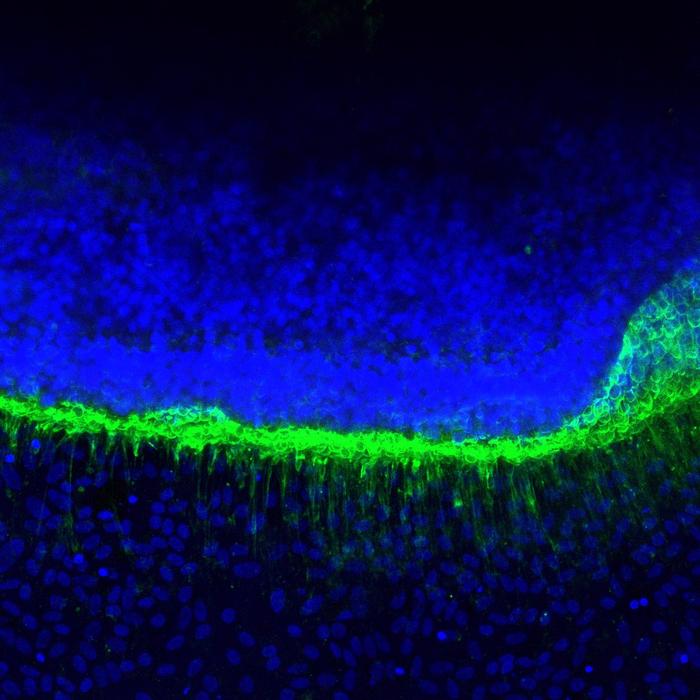 New Retina Model Reveals Early Cause of Vision Loss in Batten Disease