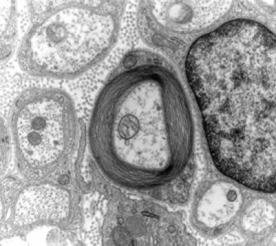 Nerve Cell