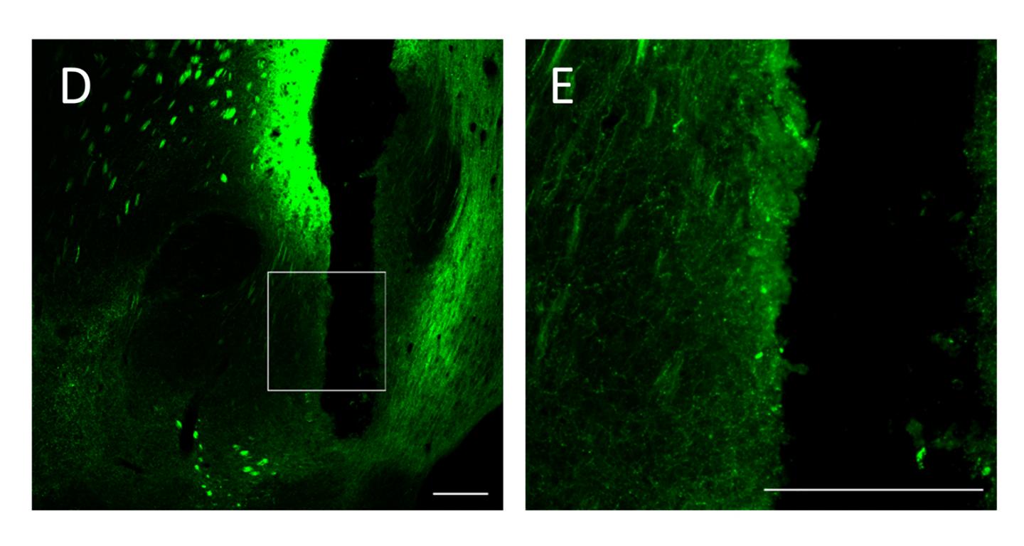 Studying Mice on Psychostimulants to Detect a Dopamine Receptor's Function (4 of 5)
