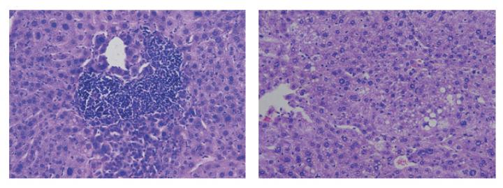 Adiponectin Inhibits Liver Cancer Development