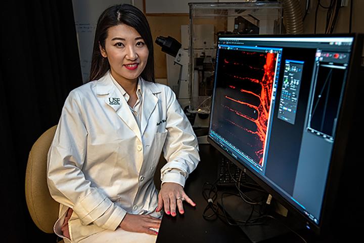 Alexa Woo, lead author, USF Health Morsani College of Medicine