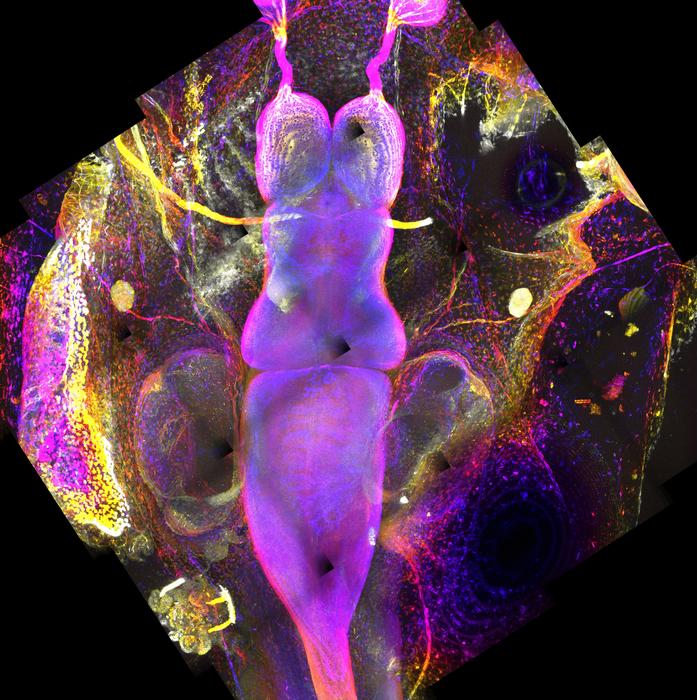 alpha-tubulin acetylation in tadpole