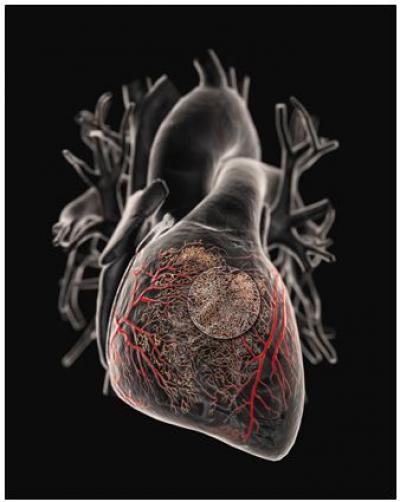 Angiogenic Microvascular Circulation