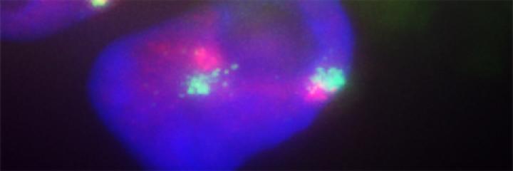 Co-accumulation of XIST and XACT on Active X-chromosomes