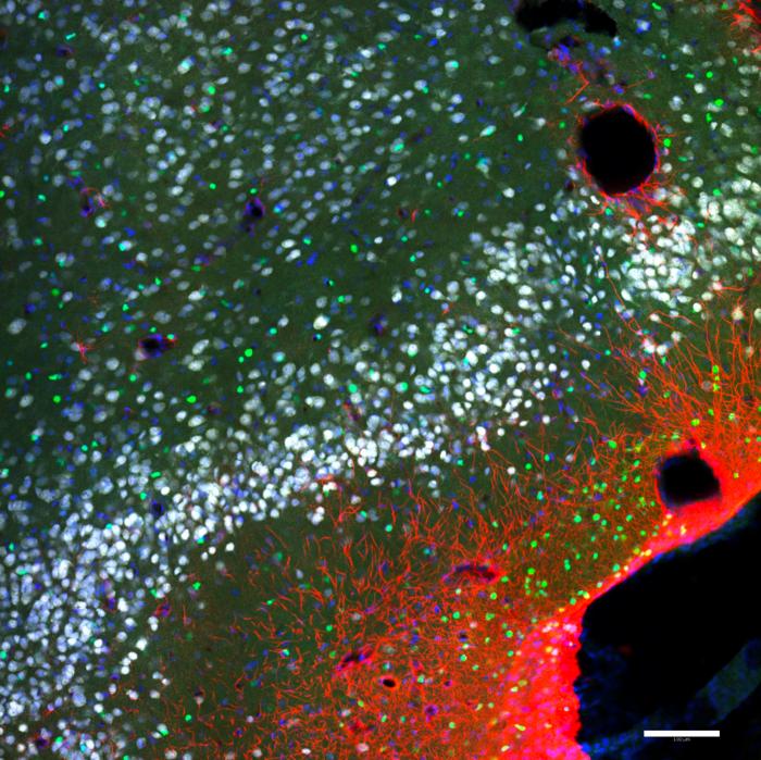 Neurons and Glia