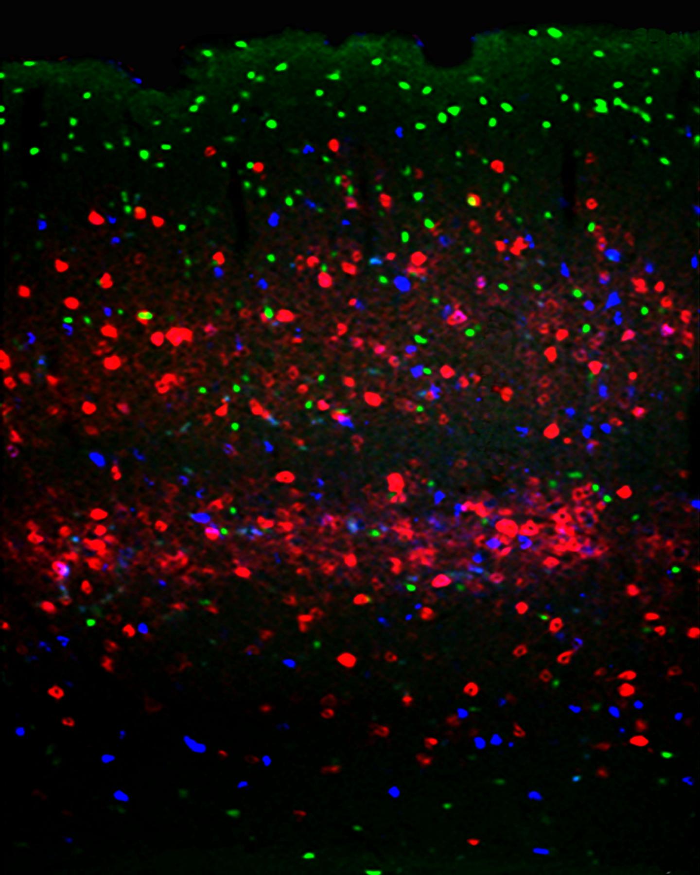 Cortical Colors