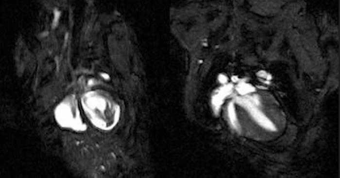 teaser of mouse beating heart