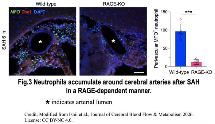 Figure 3. Neutrophils accumulate around cerebral arteries after SAH in a RAGE-dependent manner
