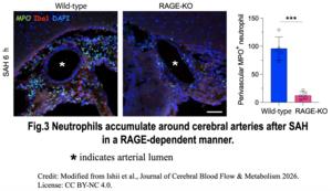 Figure 3. Neutrophils accumulate around cerebral arteries after SAH in a RAGE-dependent manner