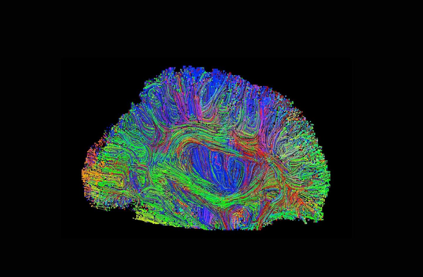 Brain Connections