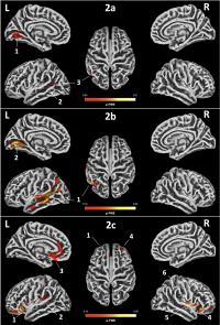 MRI results also the first to indicate relationships between screened skills and early brain development