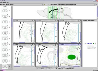 NeuART II Interface
