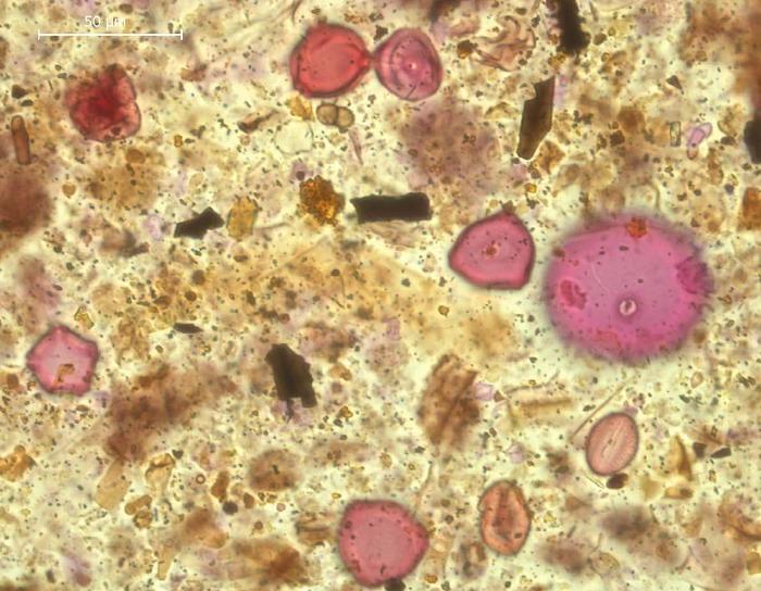 Neolithic pollen sample