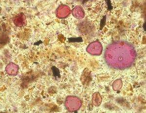 Neolithic pollen sample