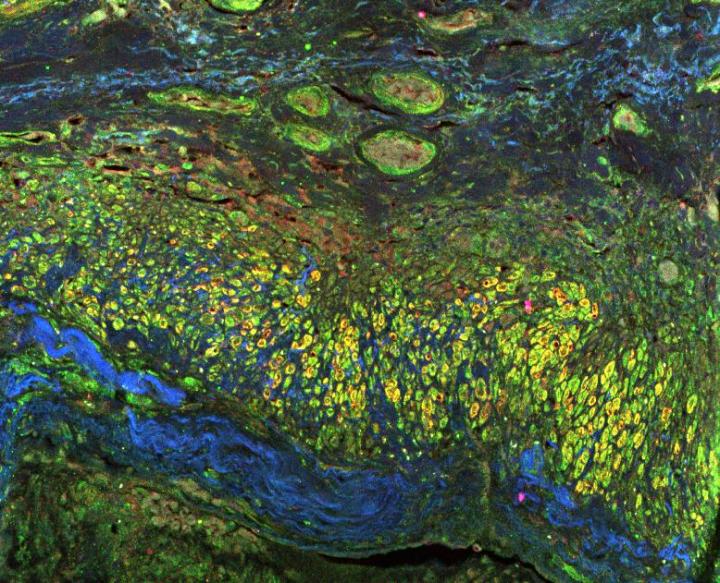 Immunostaining