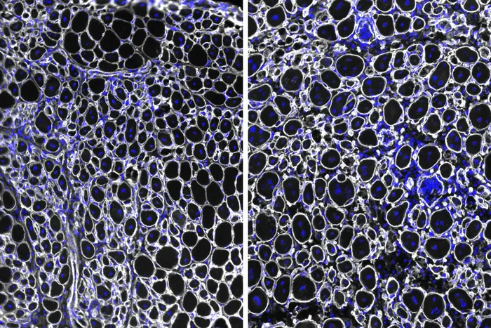 Muscle stem cells with and without NDRG1