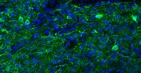 Induced Dopaminergic Neurons