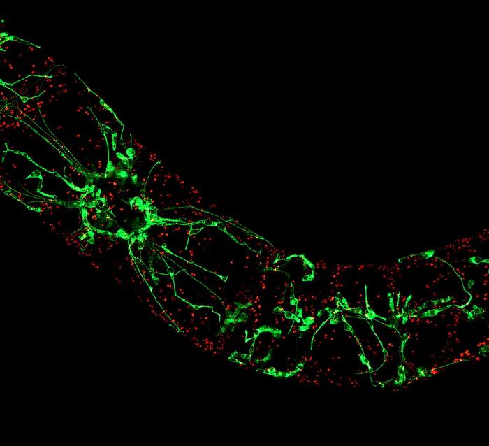 Plants defy the heat: If plants are stressed by heat or drought, projections form inside the cell that trigger protection programs. (Photo: Toranj Rahpeyma, KIT)