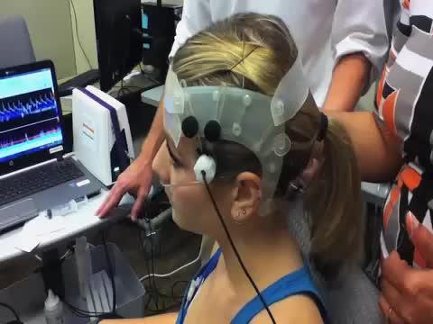 Brain Blood Flow Function: A Possible Concussion Biomarker?