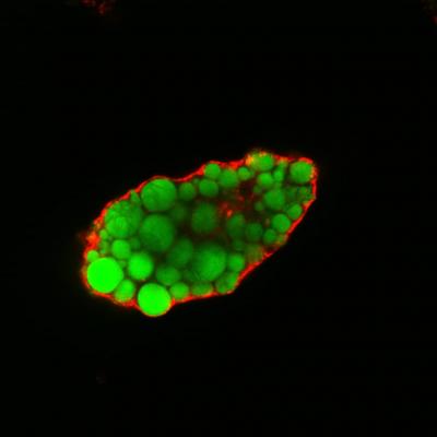 Lipid Droplets