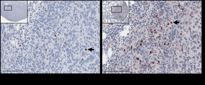 CAR-T cells irradiation