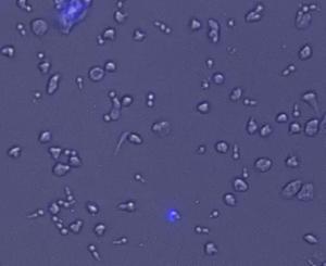 Eosinophils attacking C. albicans