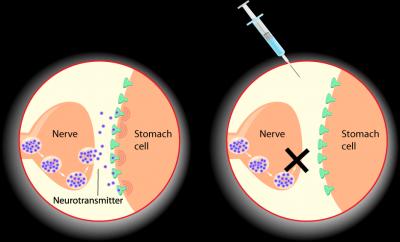 Botox Mechanism