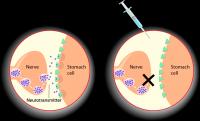 Botox Mechanism