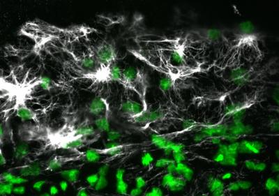 Vimentin Fluorescence