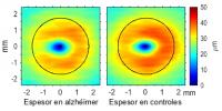 Internal Nuclear Layer