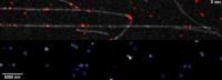 Speed and Distances mRNAs Travel On