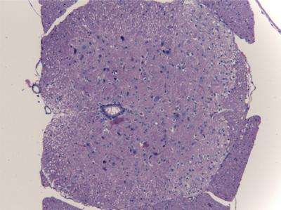 IL-9R Deficiency Ameliorates the Severity of EAE