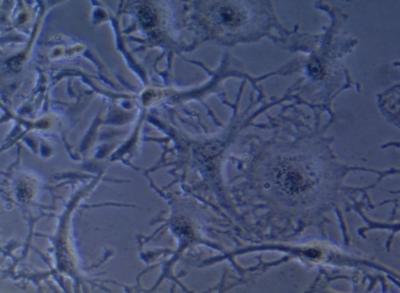 Podocytes 
