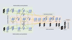 A progressive evolution in virtual MRI imaging for tumour detection