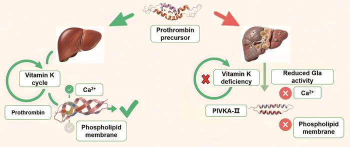 Biological significance and characteristics of PIVKA-II