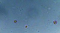 <I>Chrysochromulina</I> (2 of 2)