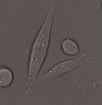 T Cell Killing Tumor