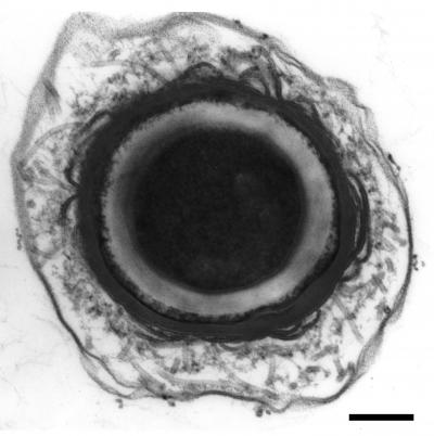 <i>Clostridium botulinum</i> Spore